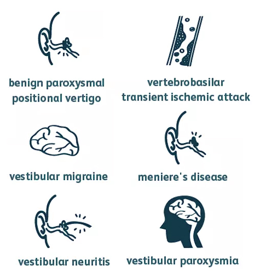 Vertigo Causes and Symptoms