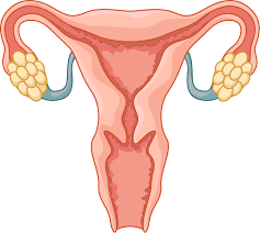 Endometriosis